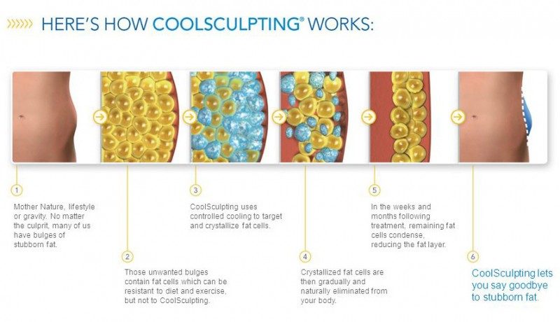 How Coolsculpting Works Hair removal by shaving