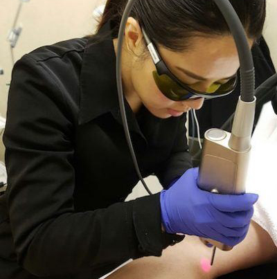 Laser Hair Removal