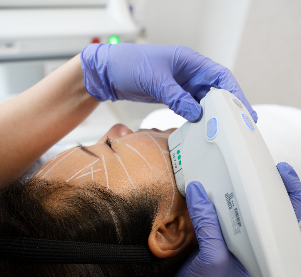 tighten skin
laser skin tightening
non surgical neck lift
loose skin tightening
Burnaby Clinic 