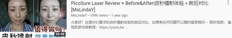 皮秒激光体验前后对比