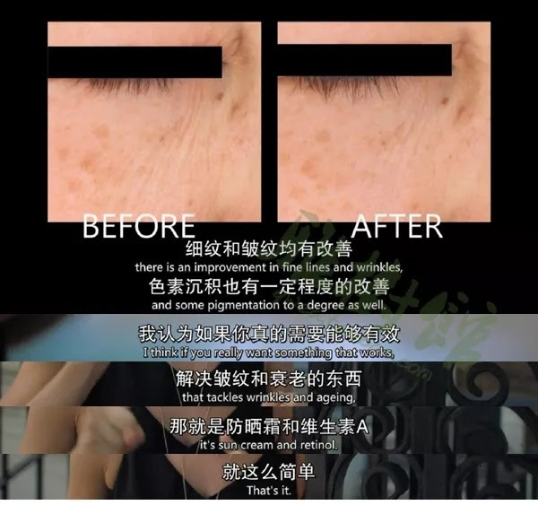 维A酸修复前后